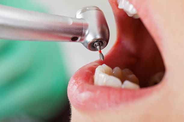 Best Weekend Emergency Dental Services in Beach, ND